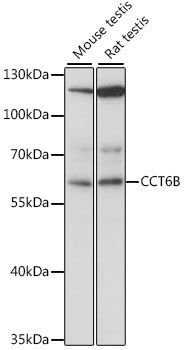 CCT6B Rabbit Polyclonal Antibody