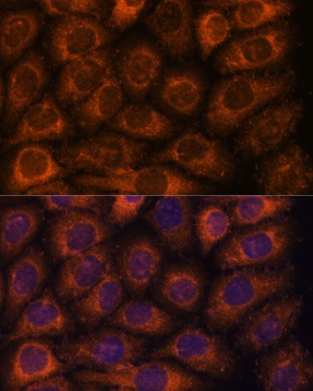 CCT6B Rabbit Polyclonal Antibody - Image 2
