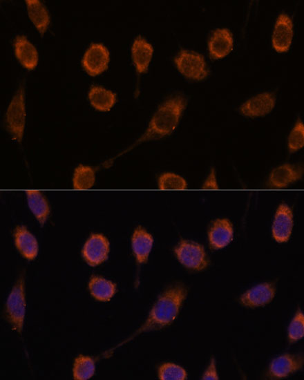 CCT6B Rabbit Polyclonal Antibody - Image 3