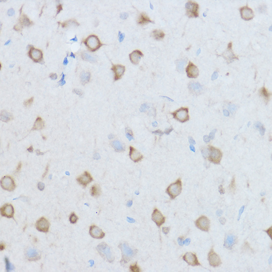CCT8 Rabbit Polyclonal Antibody - Image 2