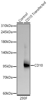 CD10 Rabbit Monoclonal Antibody