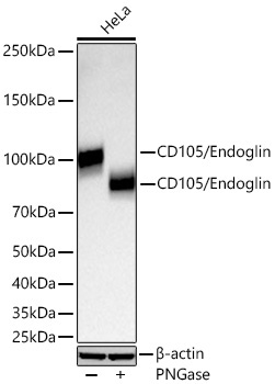 CD105/Endoglin Rabbit Monoclonal Antibody - Image 3