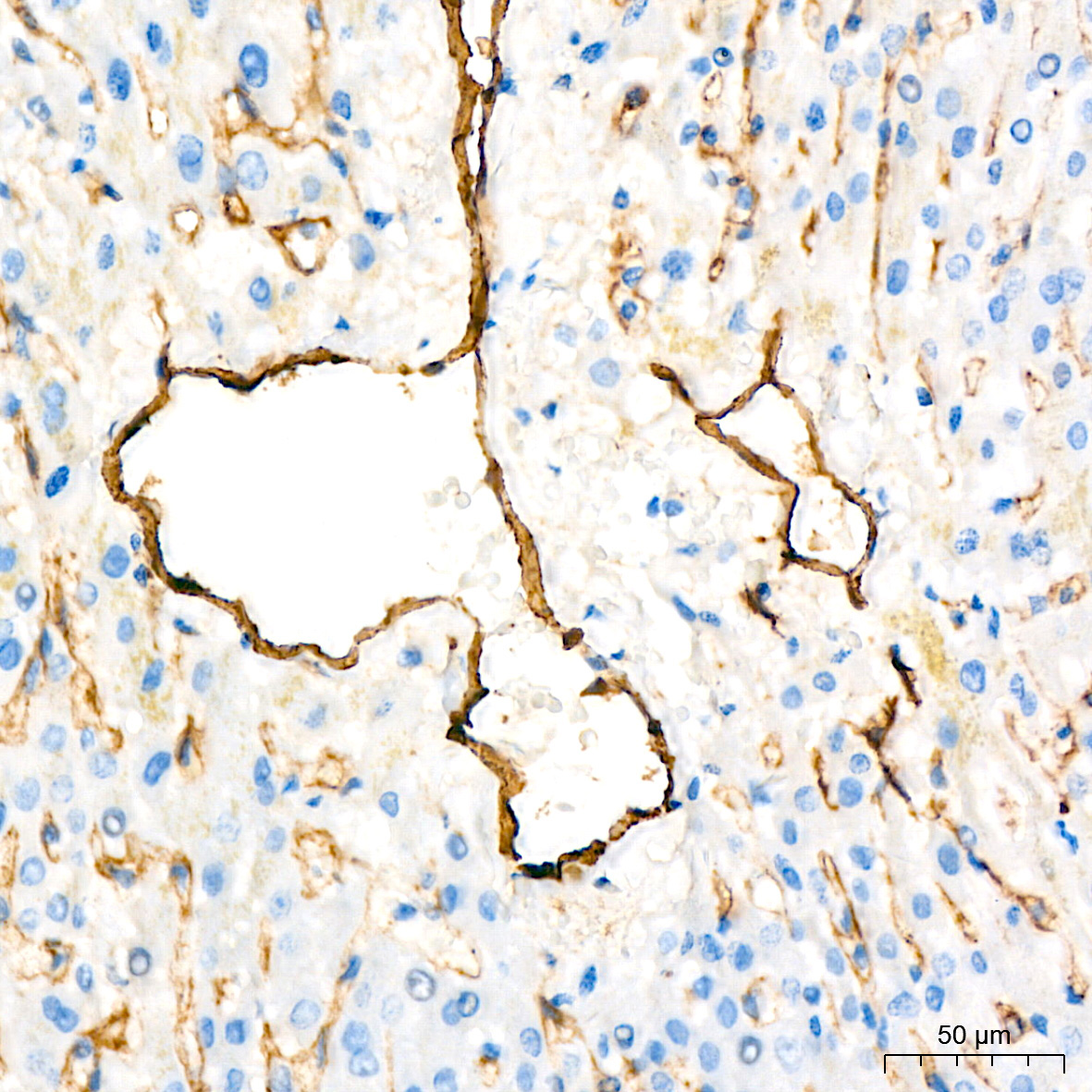 CD105/Endoglin Rabbit Monoclonal Antibody - Image 4