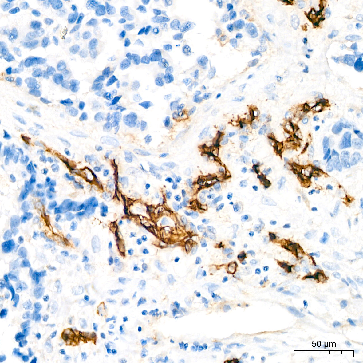 CD105/Endoglin Rabbit Monoclonal Antibody - Image 5