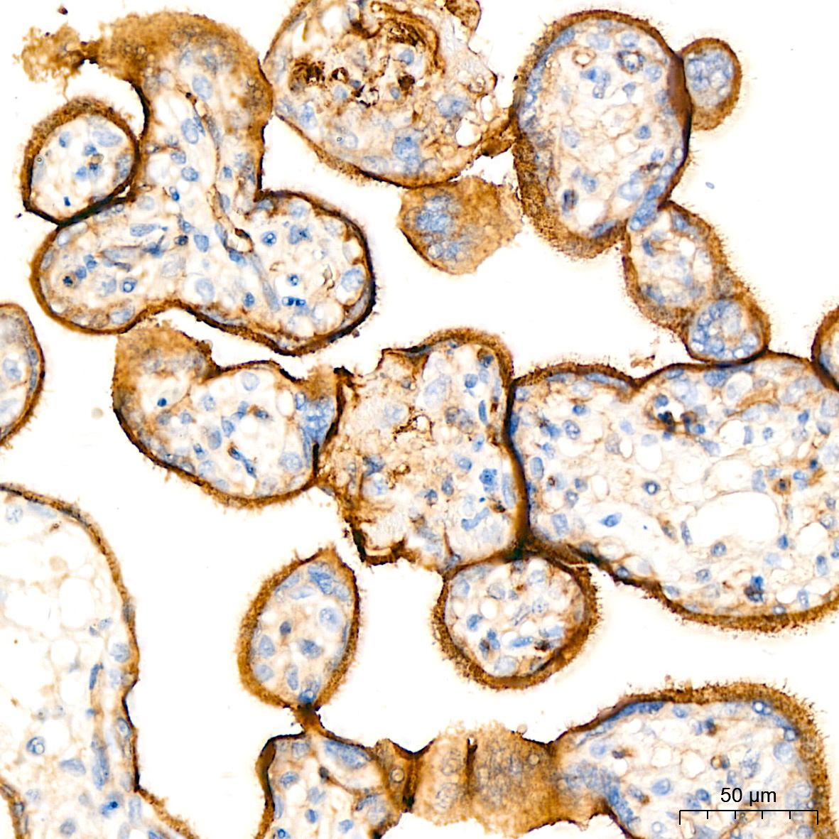 CD105/Endoglin Rabbit Monoclonal Antibody - Image 6