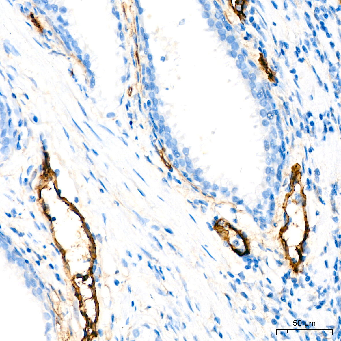 CD105/Endoglin Rabbit Monoclonal Antibody - Image 7