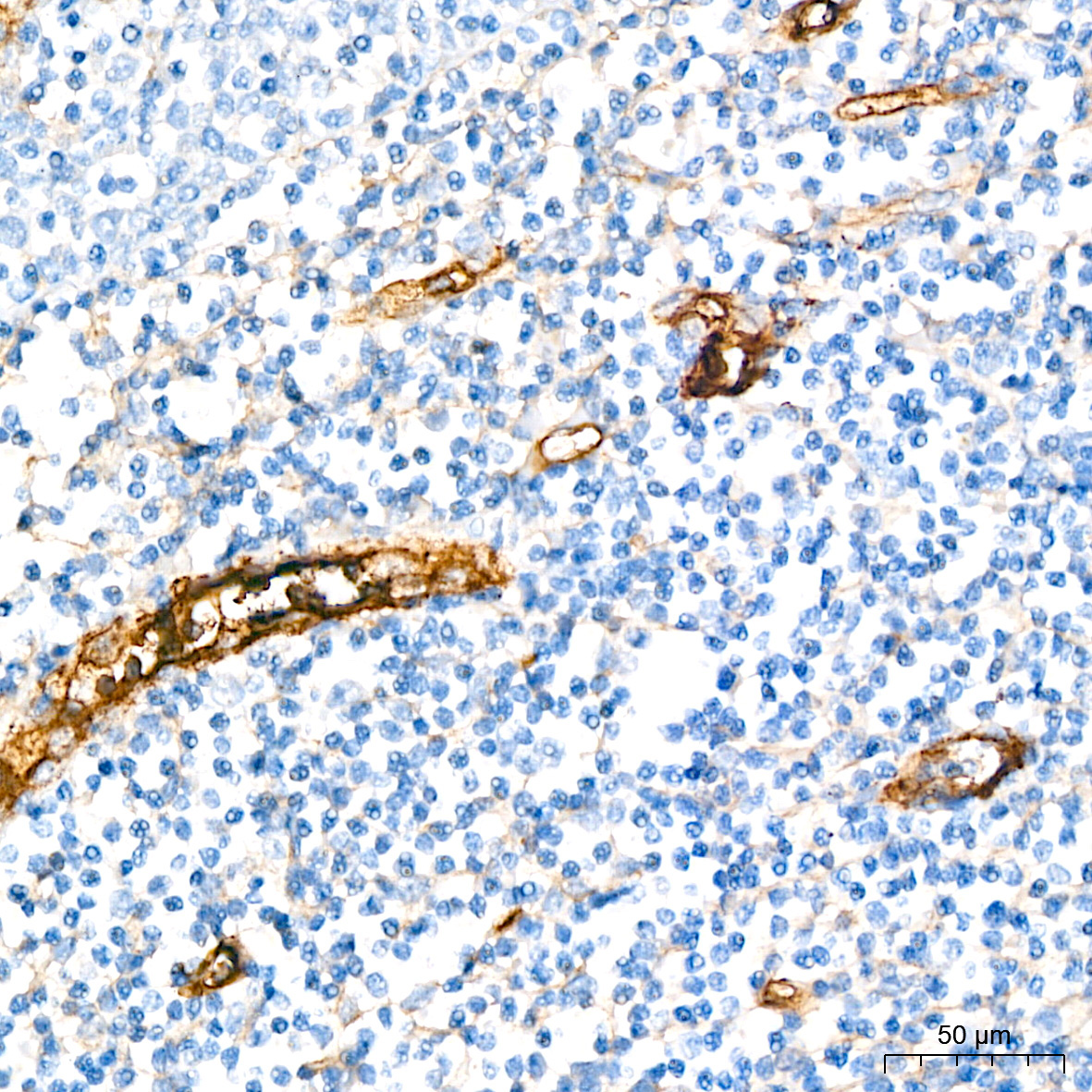 CD105/Endoglin Rabbit Monoclonal Antibody - Image 8