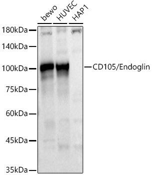 CD105/Endoglin Rabbit Polyclonal Antibody