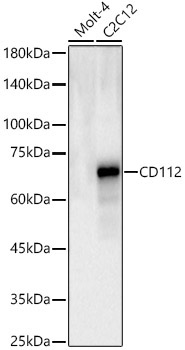 CD112 Rabbit Polyclonal Antibody