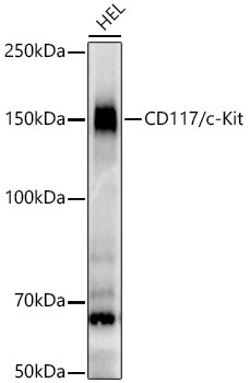 CD117/c-Kit Rabbit Monoclonal Antibody