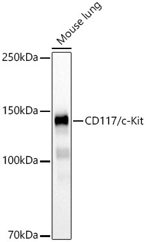 CD117/c-Kit Rabbit Monoclonal Antibody