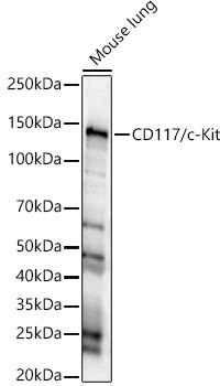 CD117/c-Kit Rabbit Polyclonal Antibody