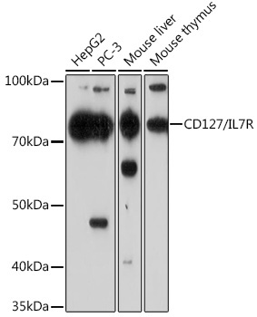 CD127/IL7R Rabbit Monoclonal Antibody