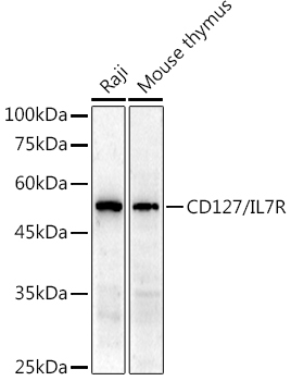CD127/IL7R Rabbit Polyclonal Antibody
