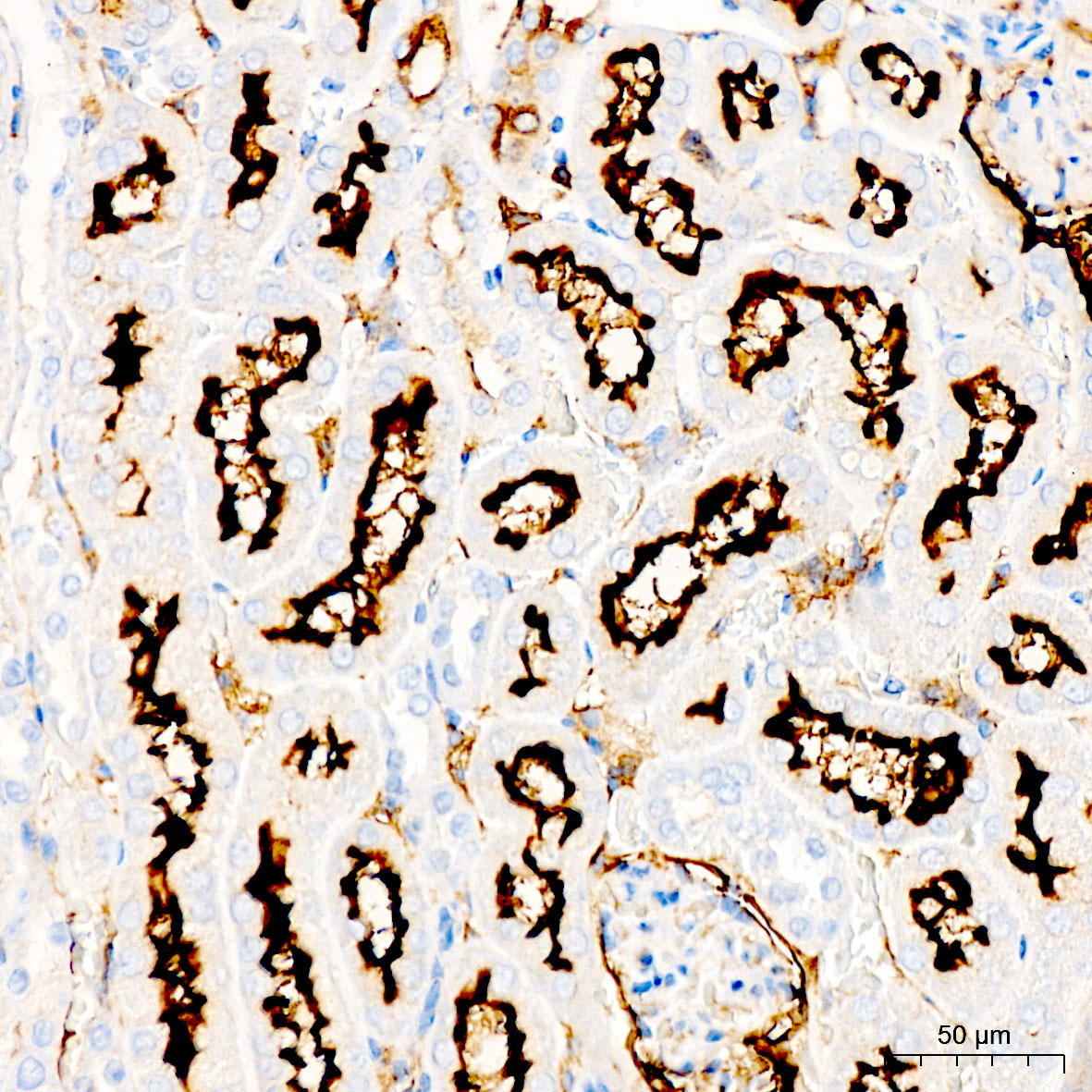 CD13 Rabbit Polyclonal Antibody - Image 3