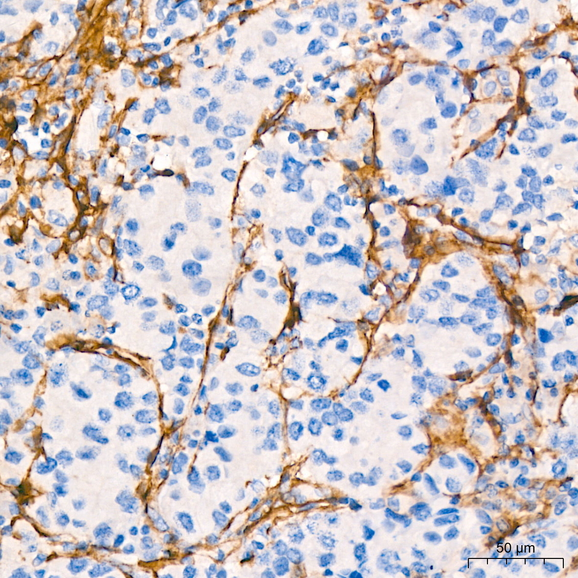 CD13/ANPEP Rabbit Monoclonal Antibody - Image 4