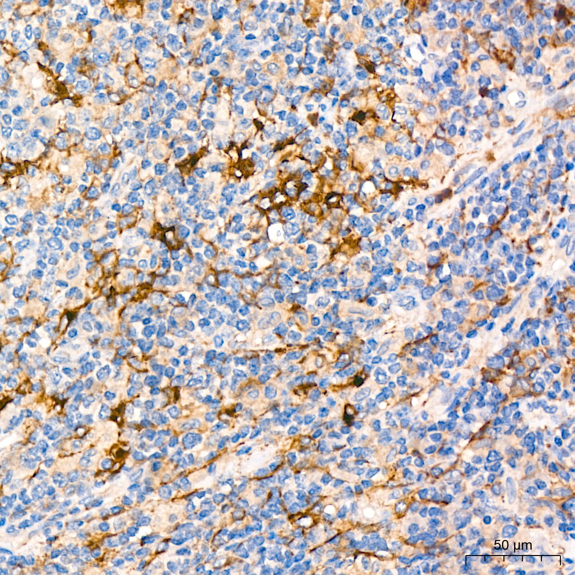 CD13/ANPEP Rabbit Monoclonal Antibody - Image 8