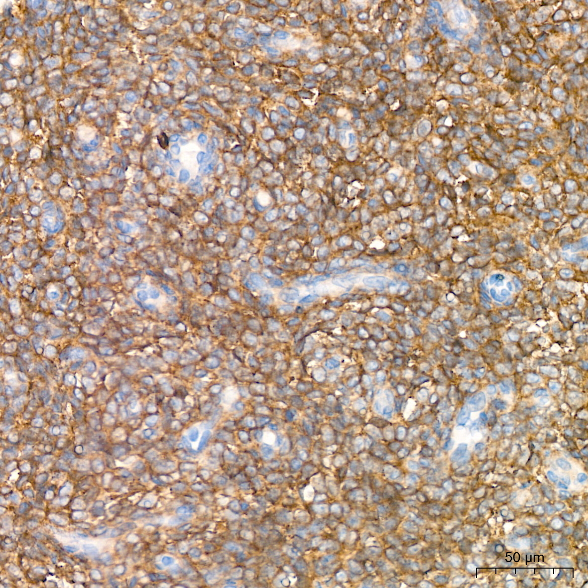 CD13/ANPEP Rabbit Monoclonal Antibody - Image 10