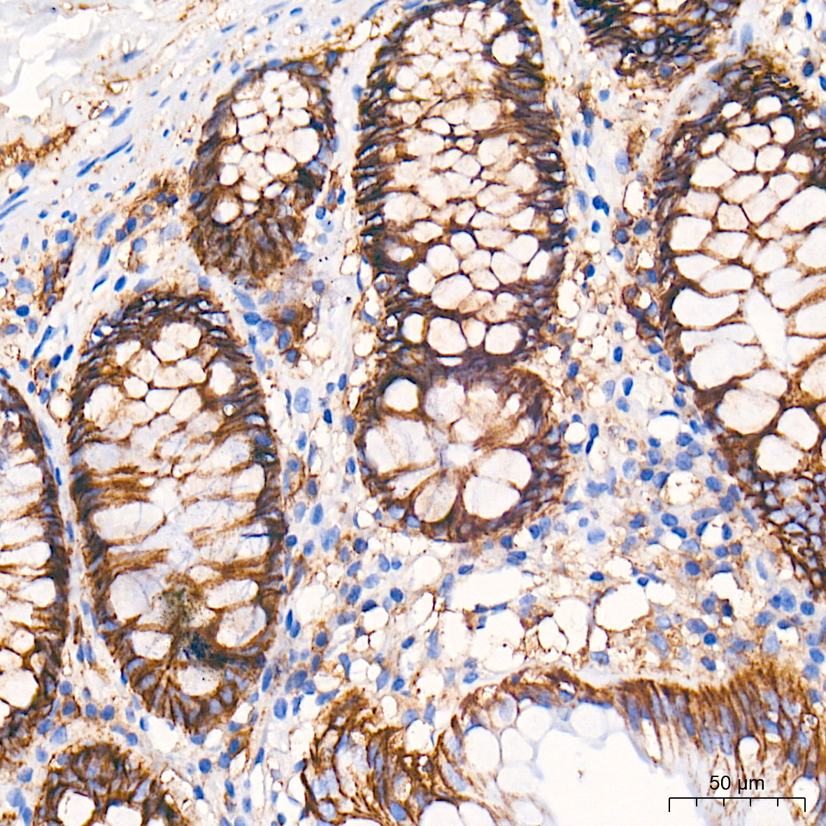CD138 Rabbit Monoclonal Antibody