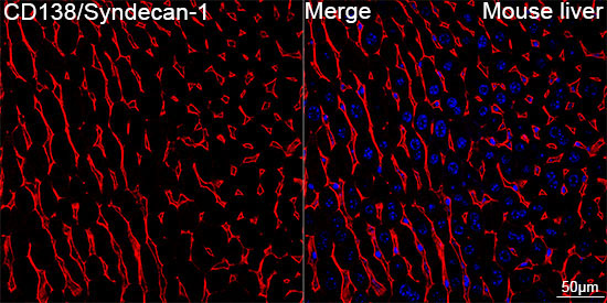CD138/Syndecan-1 Rabbit Monoclonal Antibody