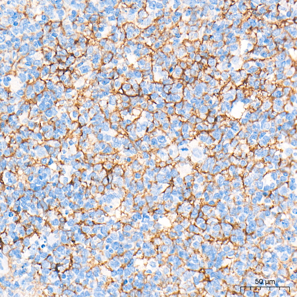 CD14 Rabbit Monoclonal Antibody
