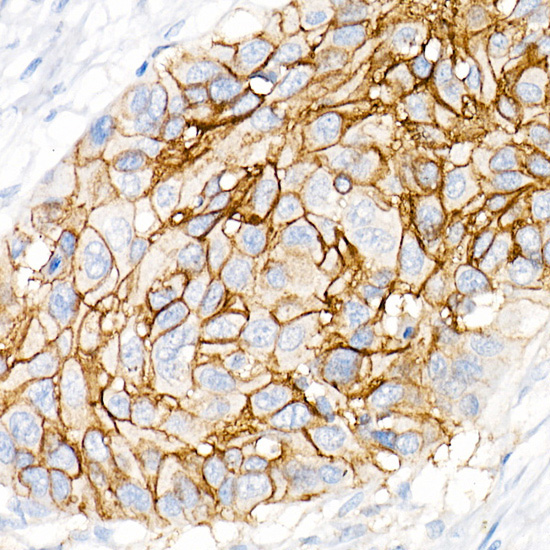 CD141/Thrombomodulin Rabbit Monoclonal Antibody