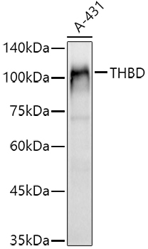 CD141/Thrombomodulin Rabbit Polyclonal Antibody