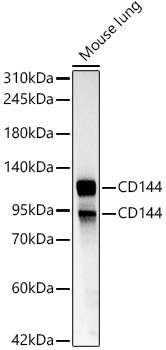 CD144 Rabbit Polyclonal Antibody