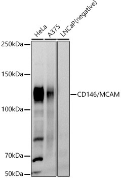 CD146/MCAM Rabbit Polyclonal Antibody