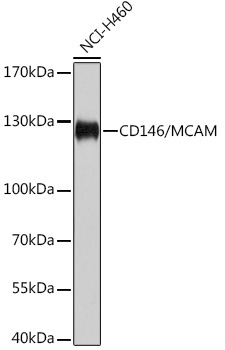 CD146/MCAM Rabbit Polyclonal Antibody