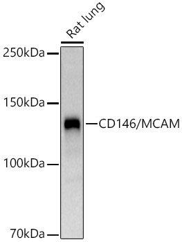 CD146/MCAM Rabbit Polyclonal Antibody