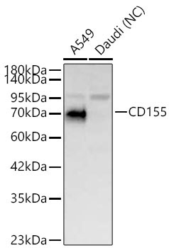 CD155 Rabbit Polyclonal Antibody
