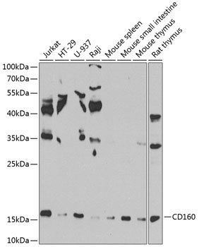 CD160 Rabbit Polyclonal Antibody