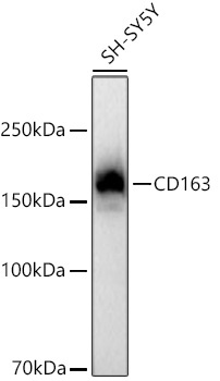 CD163 Rabbit Monoclonal Antibody