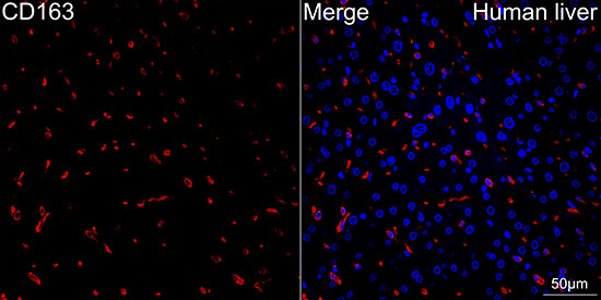 CD163 Rabbit Monoclonal Antibody - Image 2