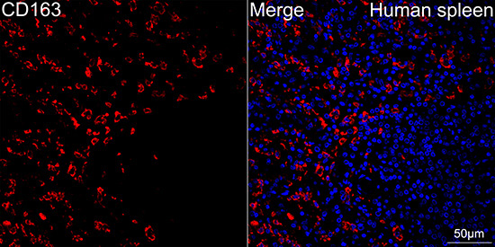 CD163 Rabbit Monoclonal Antibody - Image 3