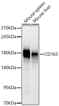 CD163 Rabbit Monoclonal Antibody