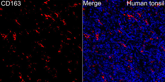 CD163 Rabbit Polyclonal Antibody