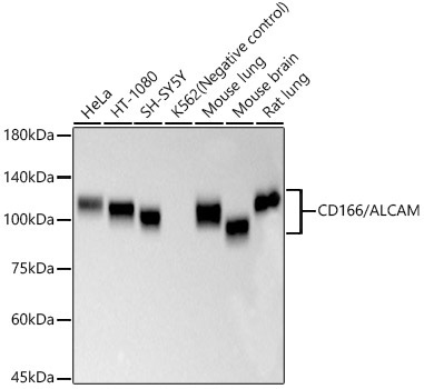 CD166/ALCAM Rabbit Monoclonal Antibody