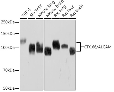CD166/ALCAM Rabbit Monoclonal Antibody
