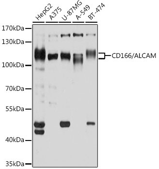 CD166/ALCAM Rabbit Polyclonal Antibody