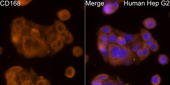 CD168 Rabbit Polyclonal Antibody