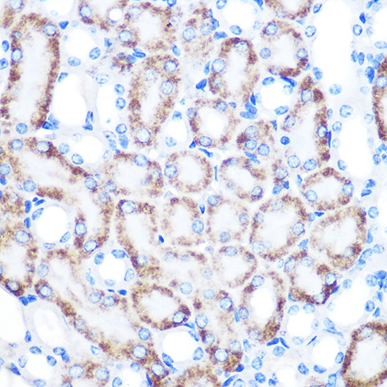 CD168/RHAMM Rabbit Monoclonal Antibody - Image 2