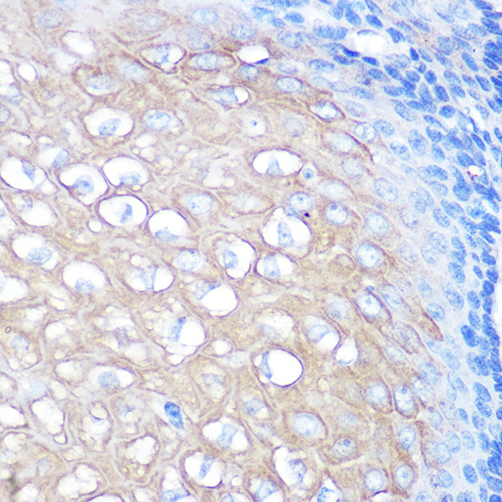 CD168/RHAMM Rabbit Monoclonal Antibody - Image 3