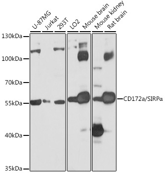 CD172a/SIRPAlpha Rabbit Polyclonal Antibody