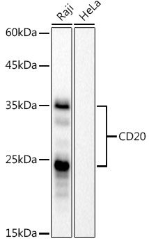 CD20 Rabbit Monoclonal Antibody