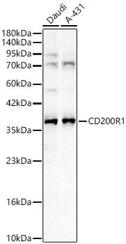 CD200R1 Rabbit Polyclonal Antibody