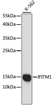 CD225/IFITM1 Rabbit Polyclonal Antibody