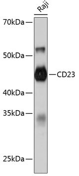 CD23 Rabbit Monoclonal Antibody