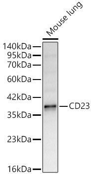 CD23 Rabbit Polyclonal Antibody